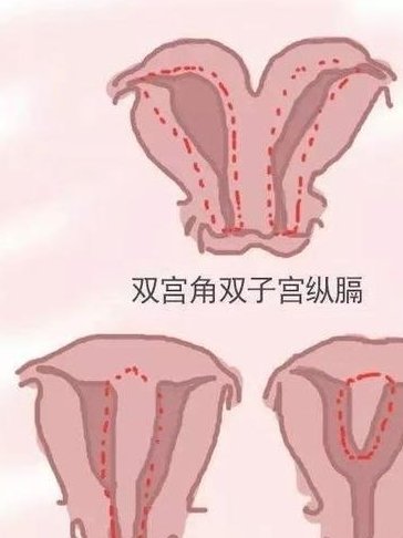 2026年四川试管婴儿费用分享，附四川试管医院排名