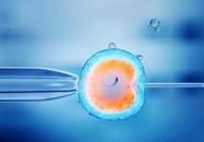 卵巢囊肿手术后月经不调？这种情况怎么办？