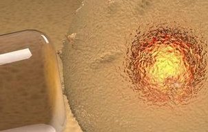 湖北试管婴儿流程是怎样的？