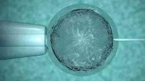 轻度弱精需要做试管吗？